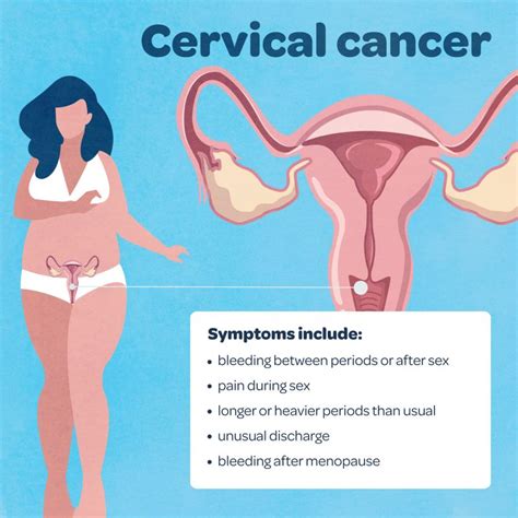 The most common symptom associated with cervical cancer is abnormal vaginal bleeding. What is gynaecological cancer and what are the symptoms ...