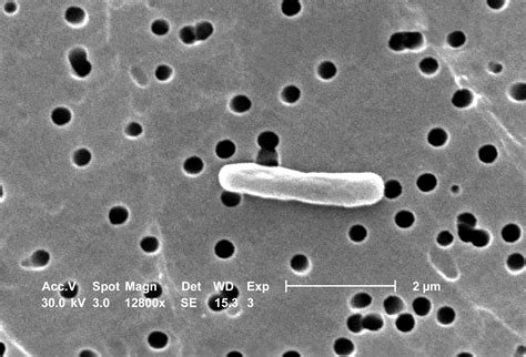 Free Picture Magnified Escherichia Coli Bacteria Magnification 12800x