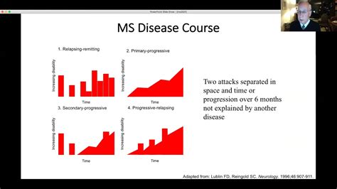 Research In Multiple Sclerosis Webinar Youtube