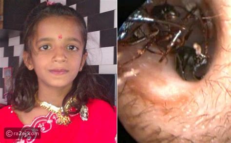 فيديو استخراج ألف نملة من أذن طفلة هندية حيرت جميع الأطباء رائج