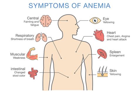 I have Anemia. Which foods should I include in my vegan ...