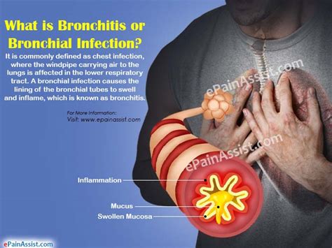 Bronchitis How Do You Get Bronchial Infection And What Is Its Treatment