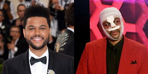 The Weeknd Reveals The Meaning Behind His Full Face Bandages The
