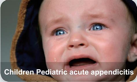 Pediatric Diseases Children Acute Appendicitis Elabscience