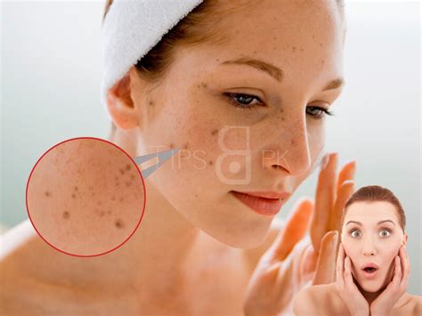Home Beauty Tips And Treatment For Dark Spots Tips