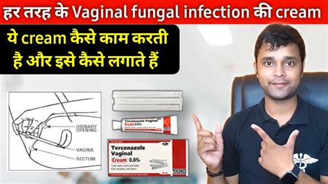 Terconazole Cream For Vaginal Fungal Infection Terconazole Cream How