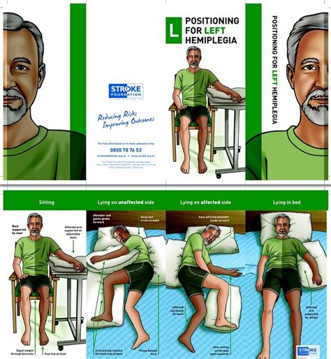 Stroke Patient Education Positioning For Left Hemiplegia Or Weakness