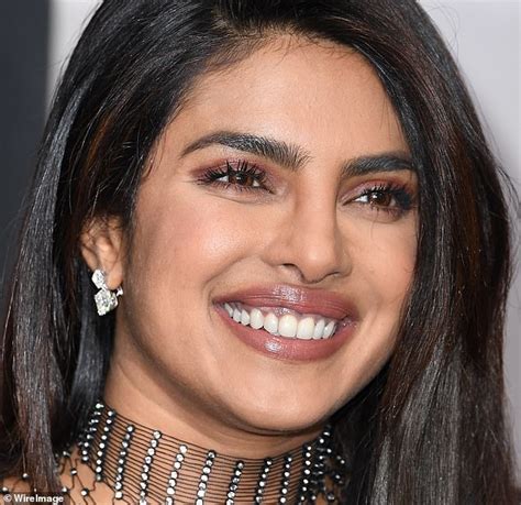 Priyanka Chopra 38 Was Called Plastic Chopra As A Teen After An Operation On Her Face Went