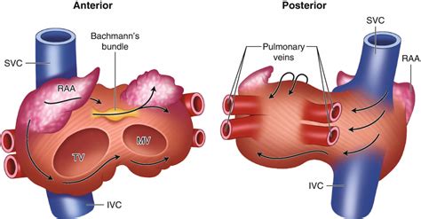 Atrium kanan adalah salah satu dari empat ruang jantung. EKG Part 4 : Pembesaran Ruang Jantung - DIFUSI REVIEW