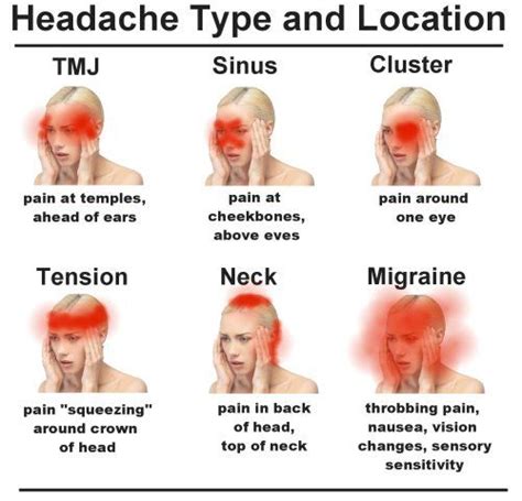 Headaches And Their Triggers Headache Types Neck Headache Headache