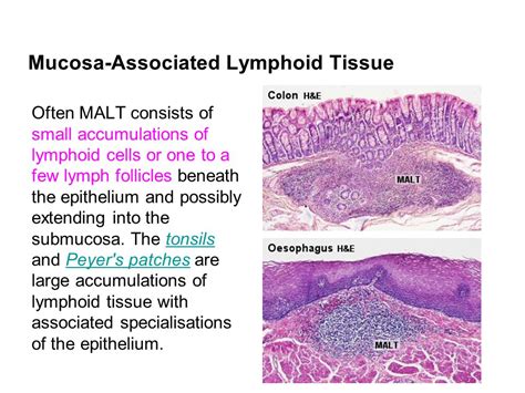 Gut Associated Lymphoid Tissue Histology