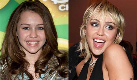 Celebrities With Braces Before And After Metal Mouth Throwback Photos Of Celebs Before After