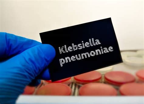 100 Klebsiella Pneumoniae Stock Photos Pictures And Royalty Free Images