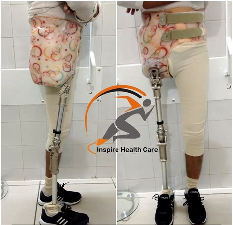 Inspire Structure Lower Extremity Prosthesis