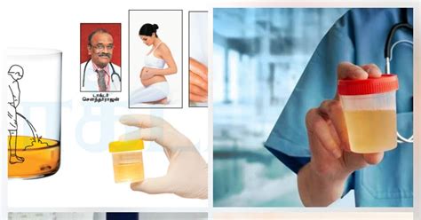 Nakarajan Urine Determines Your Diseases