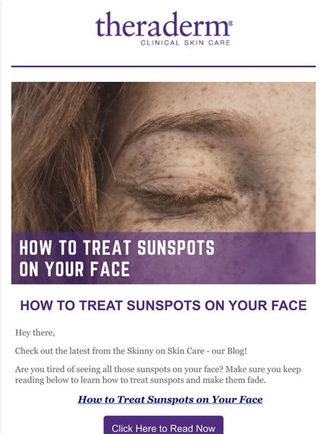 Therapon Skin Health How To Treat Sunspots On Your Face Theraderm