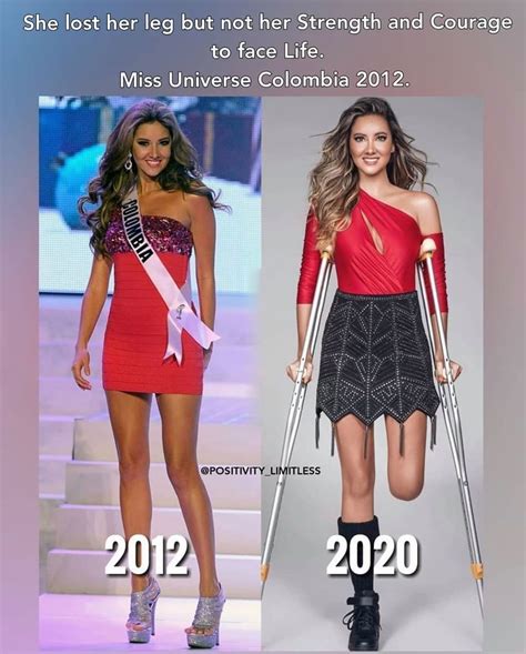 She Lost Her Leg But Not Her Strength And Courage To Face Life Miss Universe Colombia 2012