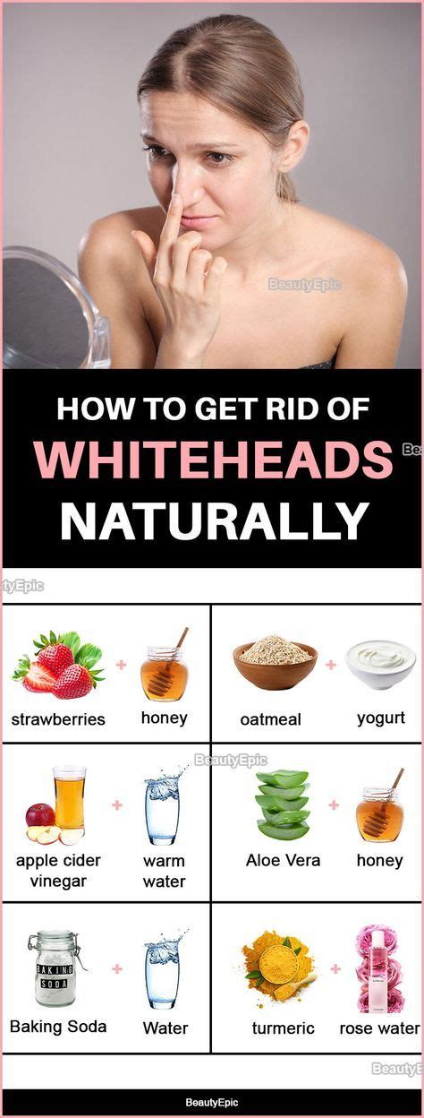 How To Get Rid Of Whiteheads Naturally At Home Oily Skin Care