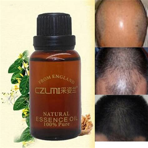 Top 11 oils for baby hair growth. Hair Boost Hair Growth Loss Products Anti Bald Alopecia ...