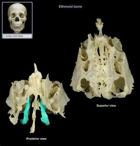 Axial Skeleton Practical Practice Anatomy And Physiology 201 Flashcards