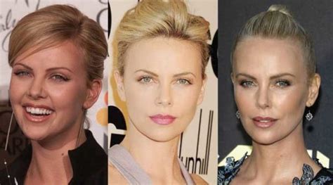 Charlize Theron Plastic Surgery Before And After Pictures 2024
