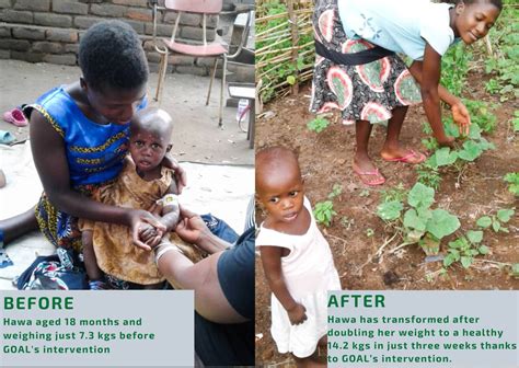 goal and irish aid combat infant malnutrition in malawi goal global