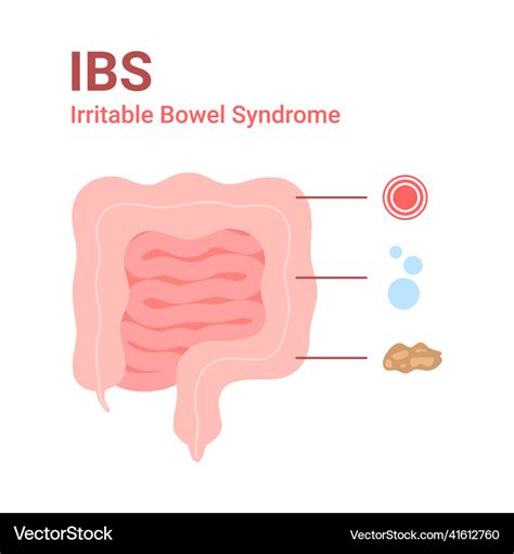 Irritable Bowel Syndrome Ibs Symptoms Royalty Free Vector