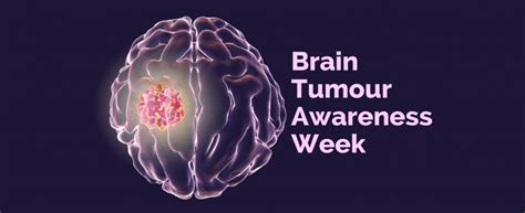 Brain Tumour Myths And Facts Kdah Blog Health And Fitness Tips For