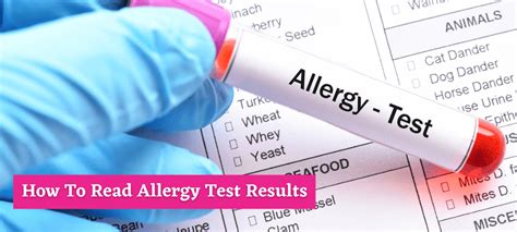 How To Read Allergy Test Results Its Not Hard As It Seems