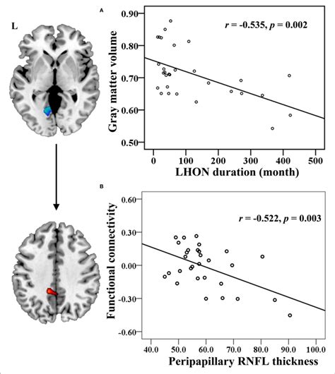Correlation Between The Neuroimaging Findings And Clinical Measures