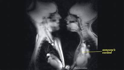Kissing Ray Gifs Human Animated Organs Humans