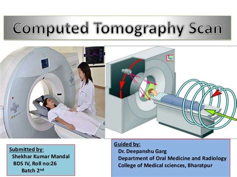 Ct Scan Final 2
