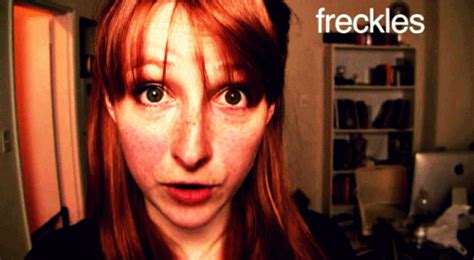 Ad Criticized For Insulting Freckled People Attn