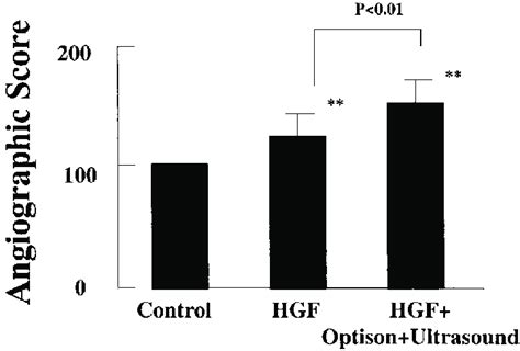 Effect Of Transfection Of Naked Human HGF Plasmid DNA In A Rabbit