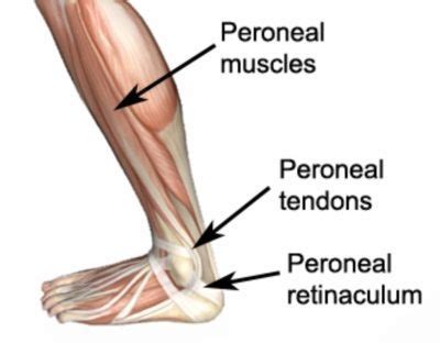 Peroneal Tendon Subluxation An T M