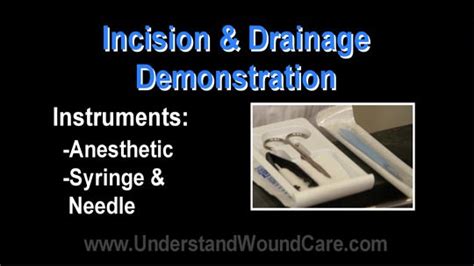 Video How To Do Incision And Drainage Of Abscess