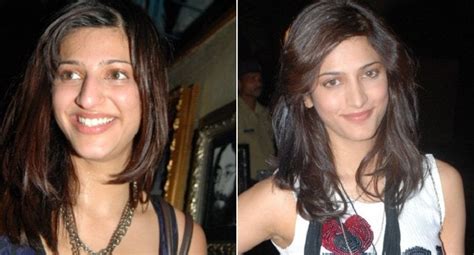 7 Bollywood Plastic Surgeries That Are Successful