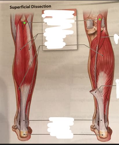 Extrinsic Muscles That Move Foot And Toes Superficial And Deep Dissection