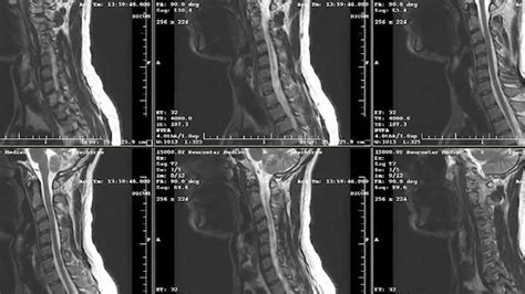 Difference Between Mri And Cat Scan Petswall