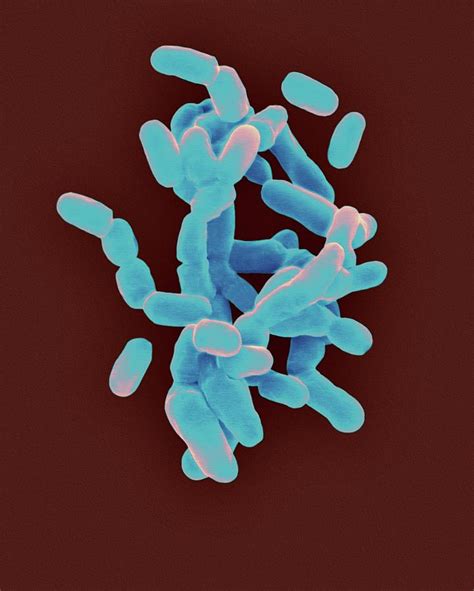 Gardnerella Vaginalis Photograph By Dennis Kunkel Microscopy Science Photo Library Pixels