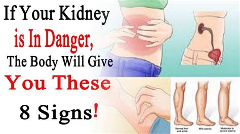 Can Back Pain Mean Kidney Problems Healthy Kidney Club