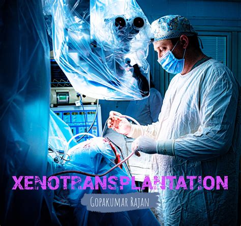 Health Wellness And Nutrition Xenotransplantation A Revolutionary