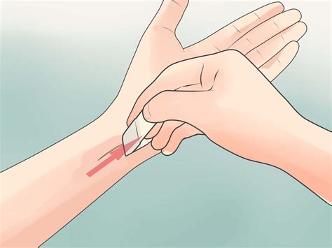 How To Treat A Minor Cut 13 Steps With Pictures Wikihow