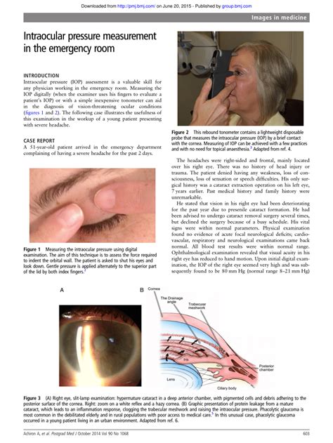 Pdf Intraocular Pressure Measurement In The Emergency Room