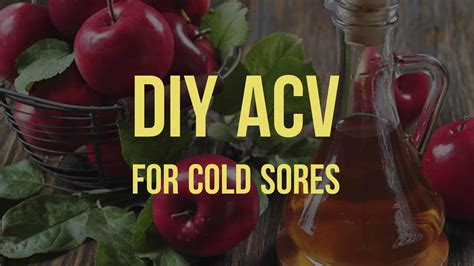 Diy Apple Cider Vinegar For Cold Sores