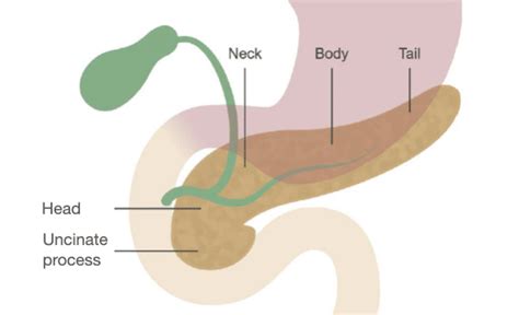 Abdominal Ct Biliary System And Pancreas • Litfl • Radiology