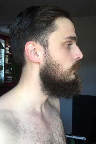 26yr Journey From Patchy Thin To Hipster Beard [week 32] Page 9 Beard Board
