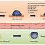 The Invasion Metastasis Cascade In Epithelium Derived Carcinomas And 