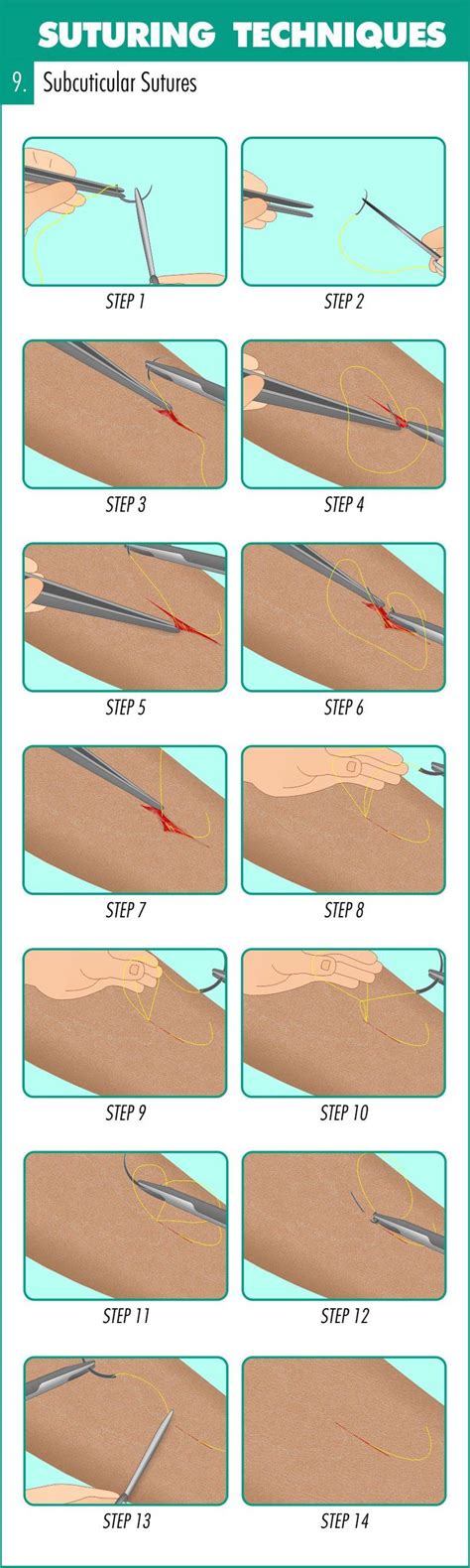 Complete Guide To Mastering Suturing Techniques With Images Suture