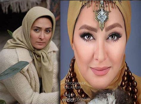 عکس های لو رفته و داغ قبل و بعد عمل زیبایی بازیگران زن ایرانی